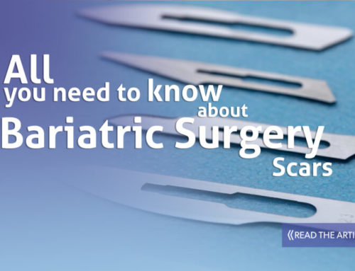 Bariatric Surgery Scars - CER Bariatrics Tijuana